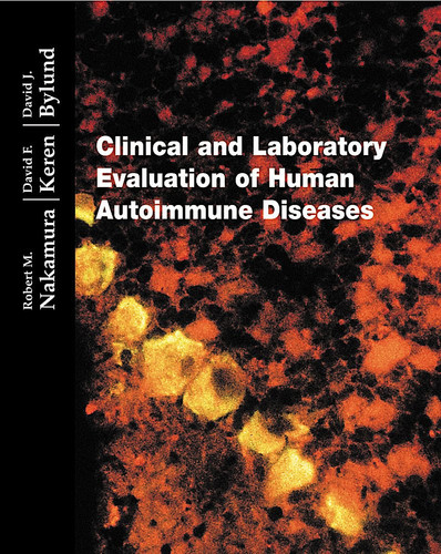 Clinical and Evaluation of Human Autoimmune Diseases