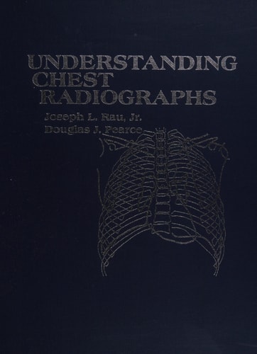 Understanding Chest Radiographs