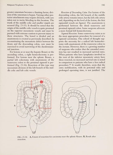 Principles and Practice of Surgery for the Colon, Rectum, and Anus