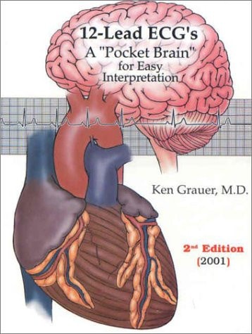 12-Lead Ecgs A Pocket Brain