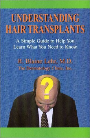 Understanding Hair Transplants