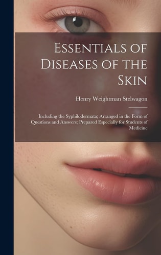 Essentials of Diseases of the Skin Including the Syphilodermata; Arranged in the Form of Questions and Answers; Prepared Especially for Students of Medicine