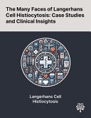 The Many Faces of Langerhans Cell Histiocytosis Case Studies and Clinical Insights