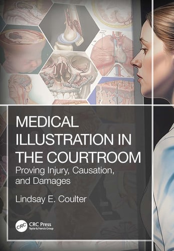 Medical illustration in the courtroom: proving injury, causation, and damages