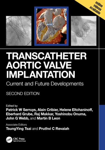 Transcatheter Aortic Valve Implantation Current and Future Developments
