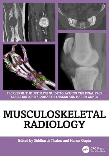 Musculoskeletal Radiology An Ultimate Guide to Passing the Final Frcr
