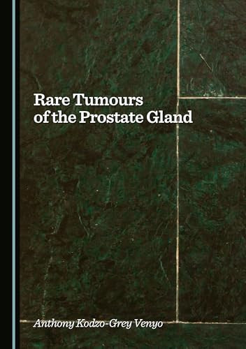 RARE TUMOURS OF THE PROSTATE GLAND.