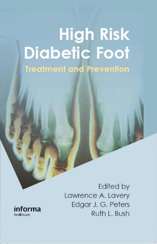 High Risk Diabetic Foot