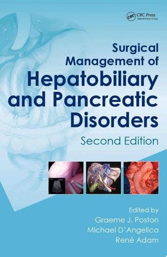 Surgical Management of Hepatobiliary and Pancreatic Disorders, Second Edition