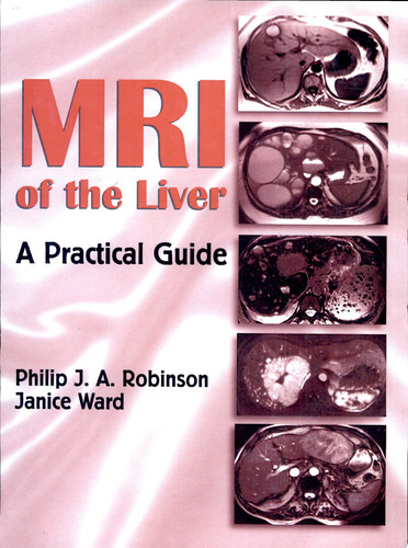 MRI of the Liver
