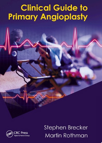Clinical Guide to Primary Angioplasty