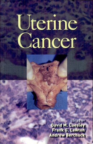 Uterine Cancer