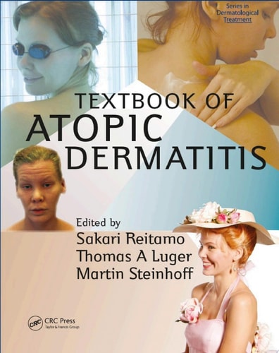 Textbook of Atopic Dermatitis