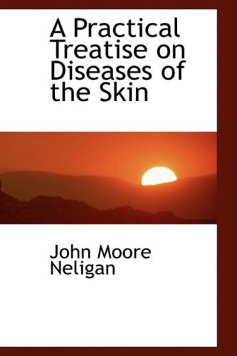 A Practical Treatise on Diseases of the Skin