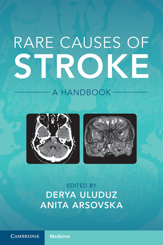 Rare Causes of Stroke