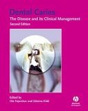 Dental Caries The Disease and Its Clinical Management