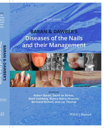 Baran and Dawber's Diseases of the Nails and their Management