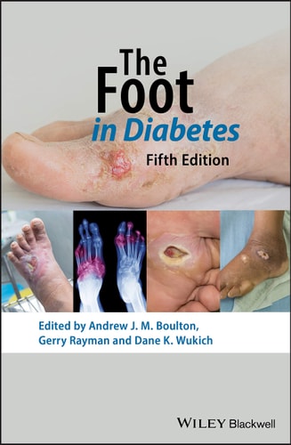 The Foot in Diabetes