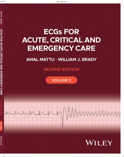 ECGs for Acute, Critical and Emergency Care, Volume 2