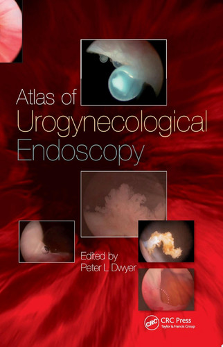 Handbook of Urologic Cryoablation