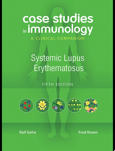 Case Studies in Immunology: Systemic Lupus Erythematosus A Clinical Companion