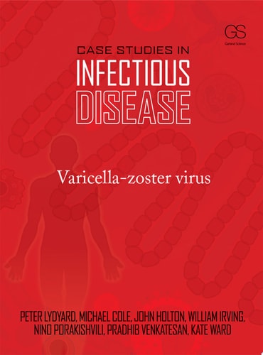 Case Studies in Infectious Disease: Varicella-zoster Virus