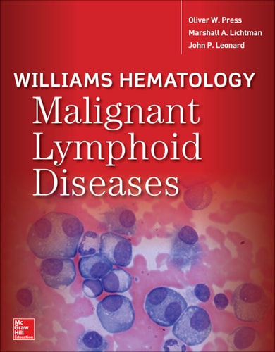Williams Hematology Malignant Lymphoid Diseases