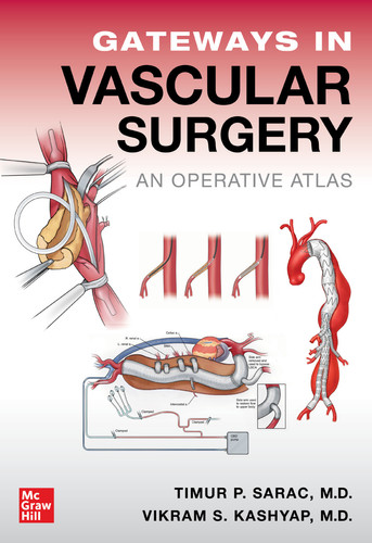 Gateways in Vascular Surgery: An Operative Atlas