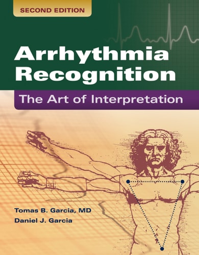 Arrhythmia Recognition: The Art of Interpretation