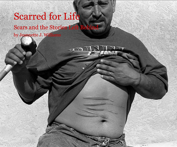 Scarred for Life