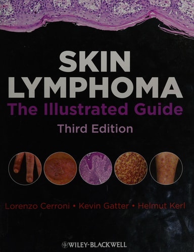 Skin Lymphoma The Illustrated Guide