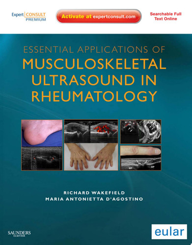 Essential Applications of Musculoskeletal Ultrasound in Rheumatology Expert Consult Premium Edition: Enhanced Online Features and Print