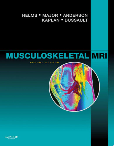 Musculoskeletal MRI E-Book