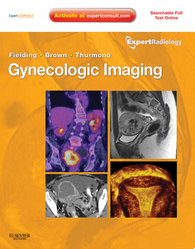 Gynecologic Imaging E-Book Expert Radiology Series