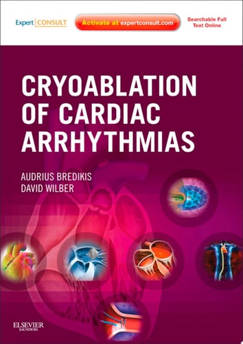 Cryoablation of Cardiac Arrhythmias E-Book