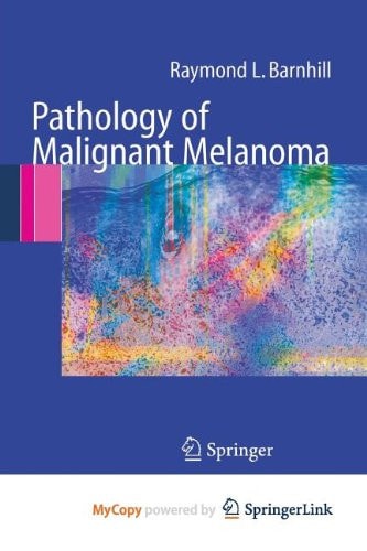 Pathology of Malignant Melanoma