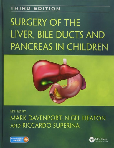 Surgery of the Liver, Bile Ducts and Pancreas in Children