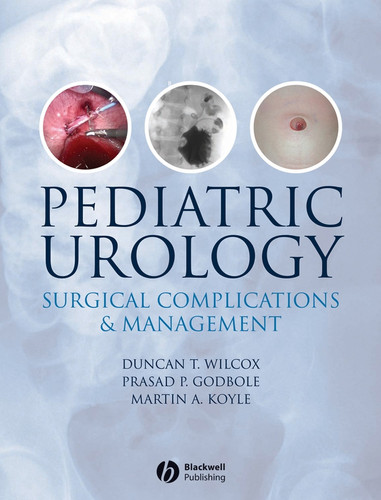 Pediatric Urology Surgical Complications and Management