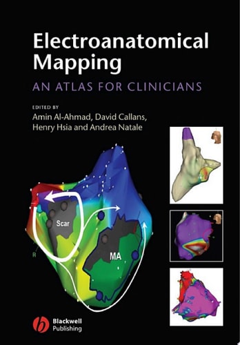 Electroanatomical Mapping An Atlas for Clinicians