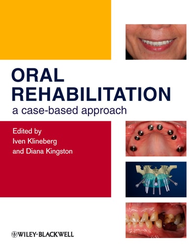 Oral Rehabilitation A Case-Based Approach