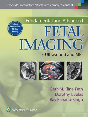 Fundamental and Advanced Fetal Imaging Ultrasound and MRI