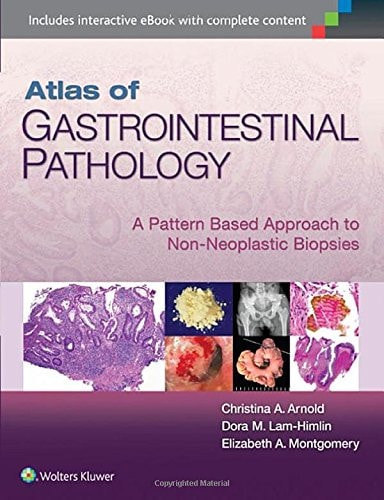 Atlas of Gastrointestinal Pathology A Pattern Based Approach to Non-Neoplastic Biopsies