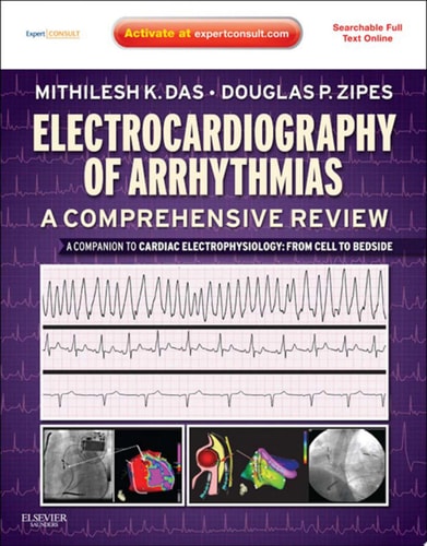 Electrocardiography of Arrhythmias: A Comprehensive Review E-Book A Companion to Cardiac Electrophysiology