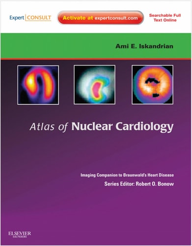 Atlas of Nuclear Cardiology: Imaging Companion to Braunwald's Heart Disease E-Book Expert Consult - Online and Print