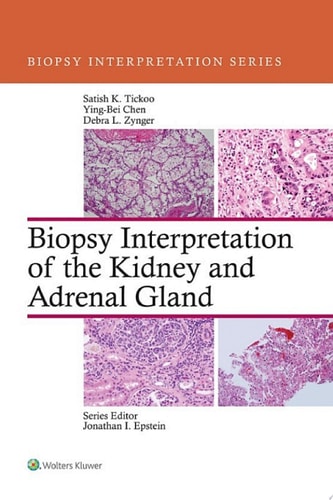 Biopsy Interpretation of the Kidney & Adrenal Gland