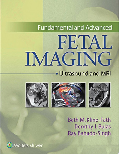 Fundamental and Advanced Fetal Imaging Ultrasound and MRI