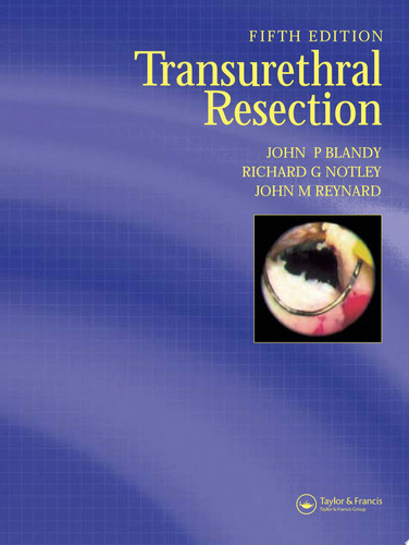 Transurethral Resection