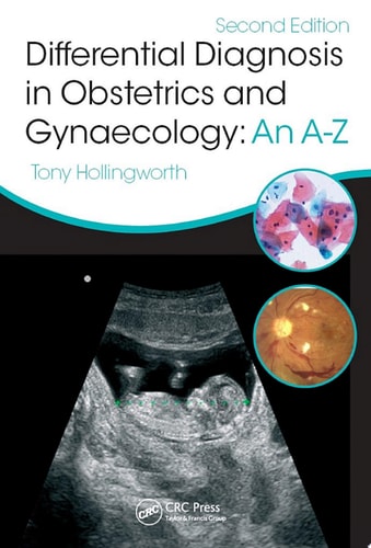 Differential Diagnosis in Obstetrics & Gynaecology