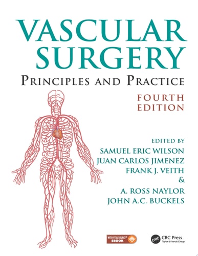 Vascular Surgery Principles and Practice, Fourth Edition
