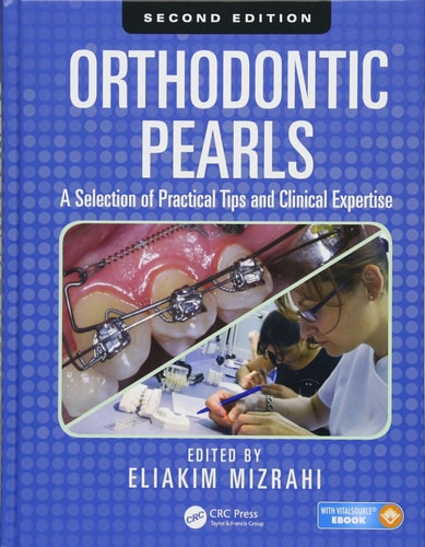 Orthodontic Pearls A Selection of Practical Tips and Clinical Expertise, Second Edition